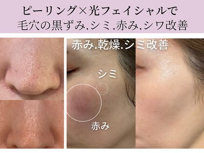 ココリールの写真