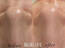 リスポアラボ(LIS PORE.LAB)/