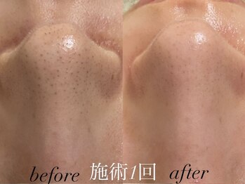 リスポアラボ(LIS PORE.LAB)/