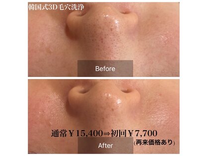 コンジュ(kongju)の写真