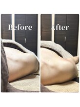 フィール(feel)/整体＋リンパ　Before & After