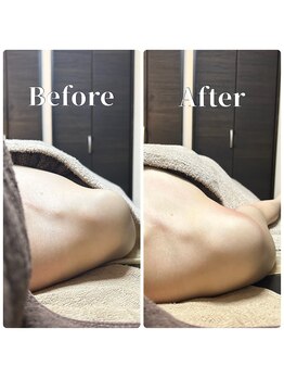 フィール(feel)/整体+リンパ Before & After