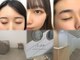 ニコ(Niko)の写真
