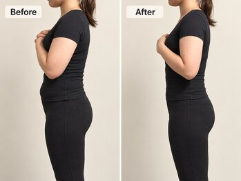 ヨサパーク よもら 大濠公園(YOSA PARK)の写真/10回目の変化♪【運動なし・食事制限なし】背中・お腹・二の腕もすっきり！