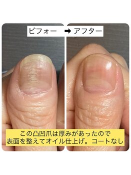 桃の木 吉祥寺店/爪を触る癖で凸凹爪になる事も