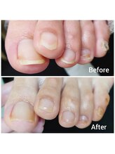 リゼラアンドコー 相模大野店/ドイツ式フットケア専門店