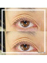 ナイン ゴー(Nine go)/コスメラッシュリフト