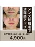 【メンズリピート率No.1★】メンズ髭脱毛(ヒゲ全体) ¥4900