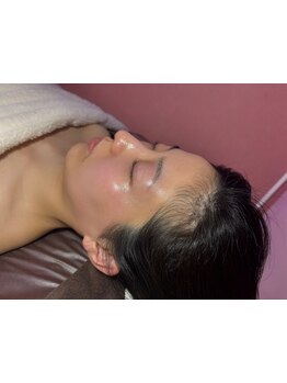 顔脱毛がしたい