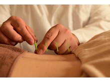 マーキュリー(Mercury)/東洋鍼灸