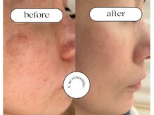 ユヌランコント 岐阜店(Une rencontre)/エンビロン