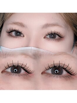 ナポーラ(NAPORA)/