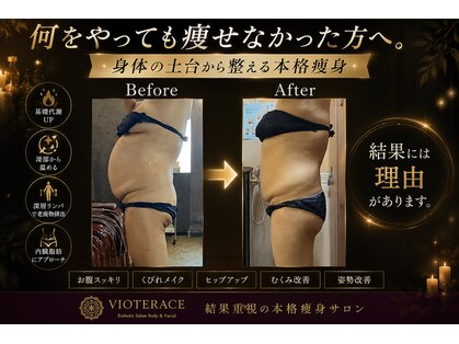 ヴィオテラス(VIOTERACE)の写真