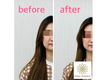ハリエッセンス(HARI ESSENCE)の写真
