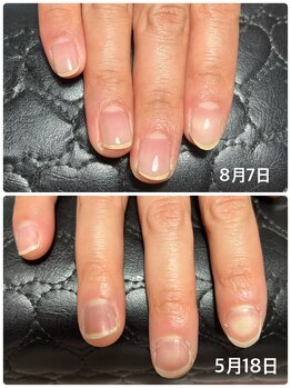 ヴィプラス(Vi+)/美爪育成のお客様