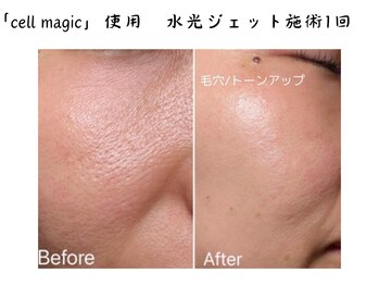 からだ庵 弘明寺本院/幹細胞×水光　毛穴トーンアップ