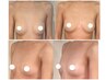 骨格筋からの結果出しだからヌード変わる！美姿勢×美乳へ♪¥22,000→¥14,900