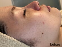 サロン ド エメ(salon de aimer)/【Before】ざらつきが気になる方