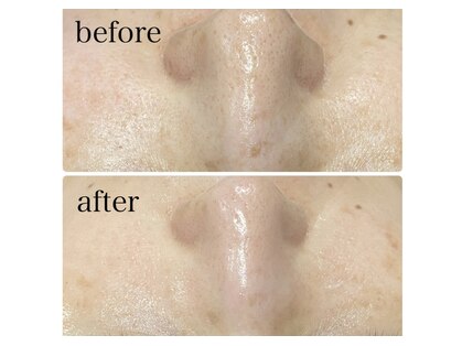 リボーン(Ribbo-n)の写真