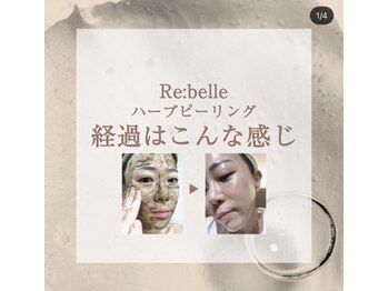 ハーバリー ハーブピーリング 岐阜(HERBERRYハーブピーリング)/ハーブピーリング専門店HERBERRY