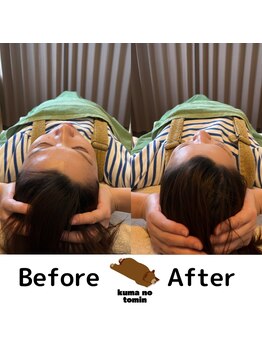 クマの冬眠 高知店/あたまほぐし