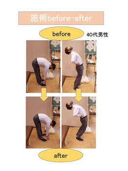 いみすぽ整体/40代男性ビフォアアフター