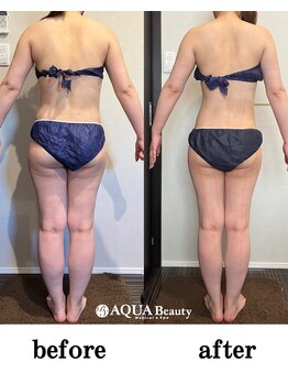 ビーエスアクアビューティー/