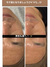 ナナラ(NANALA)/メンズ様も美肌へ