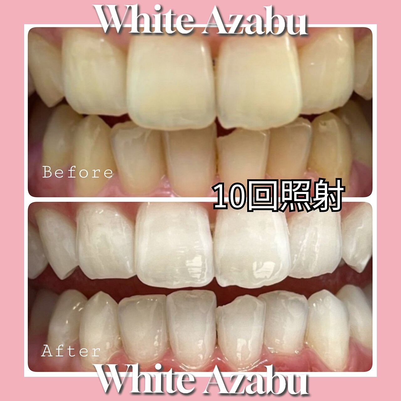 ホワイト アザブ(White Azabu)｜ホットペッパービューティー