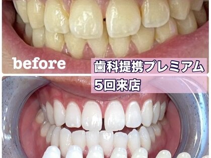 エマ(EMMA)の写真