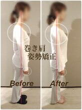 ティーエスエル とがし整体ラボ(TSL とがし整体 Labo)/ブライダル整体/骨盤矯正/反り腰