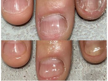 グレースレディ/噛んでも大丈夫