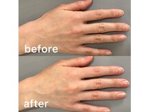 オテテ アイアンドハンド(otete eye&hand)の雰囲気（丁寧にケアいたします◎当店のスクラブはとてもこだわってます。）
