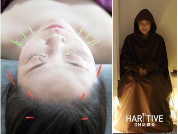 ハリティブ(HARITIVE)の写真/鍼デビューは女性専門の当院で！美容鍼/自律神経の乱れ/首肩こり/頭痛/眼精疲労は経験豊富な女性院長が解決