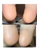 韓国式足裏角質ケア【１ヶ月以内】11,000→6,600円（60分～90分）