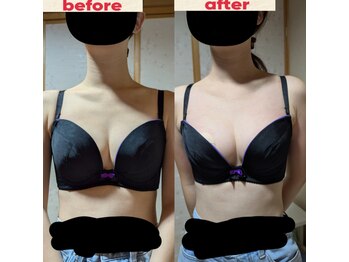 スノードロップ(snowdrop)/