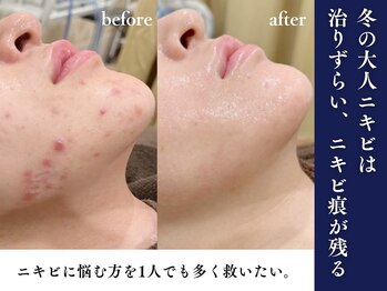 エピア 豊橋店(Epia)