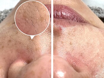 レネットサロン(Reinette Salon)/お顔ワックス