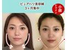 【2回目以降の方】前回の施術から1ヶ月以内のご来店で◎継続美容鍼