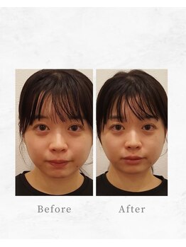 リファイン整体院 国分寺店/小顔、骨盤、ヘッドスパ、整体