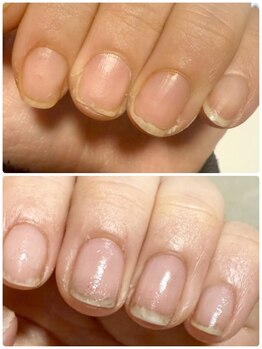レジーナネイル(Reginanail)の写真/本格ケアで爪が育つ！マニキュアで育成ができつ技術で、理想の指先へ導きます☆