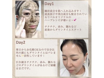 ハーバリー ハーブピーリング 岐阜(HERBERRYハーブピーリング)/最強ハーブピーリング【リベル】