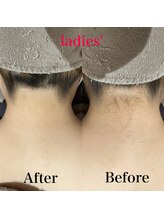 ミーエイト(Mii∞)/《襟足Before/After》