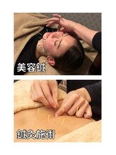 フォーユー鍼灸整骨院 登美ヶ丘院 フォーユーフィット 登美ヶ丘店(for you fit)/美容鍼　鍼灸施術