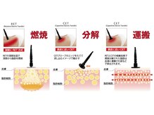 ワイズビューティー(Y's Beauty)/ラフォス