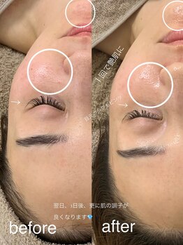 ニコ(25)/ラミピール