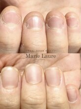 マリーロール 天王寺店(Marie Laure)/自爪育成/深爪矯正/ネイルケア