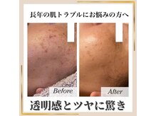ココ(KOKO)/透明感とツヤに驚き