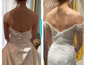 リシェカ(Richeka)/ブライダルエステ