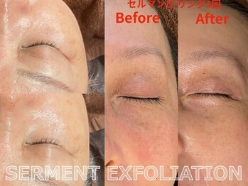 ココモンド(COCOMONDO)/セルマン艶肌ピーリング